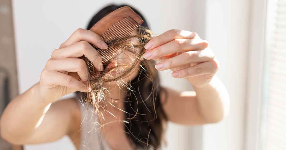 chute de cheveux